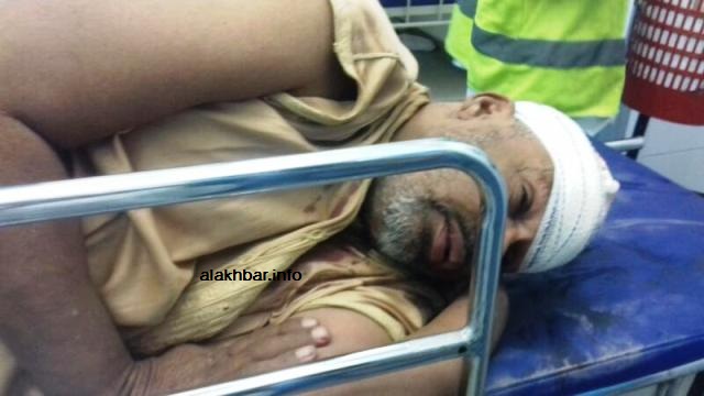 أصيب هذا الرجل - وهو مقعد - عدة إصابات في رأسه وأطرافه 