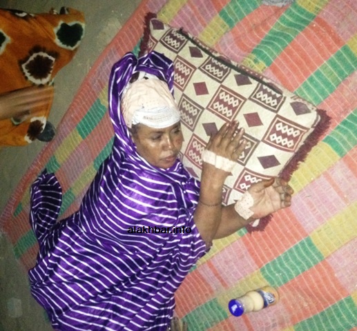 أصيبت هذه السيدة بسكين في رأسها