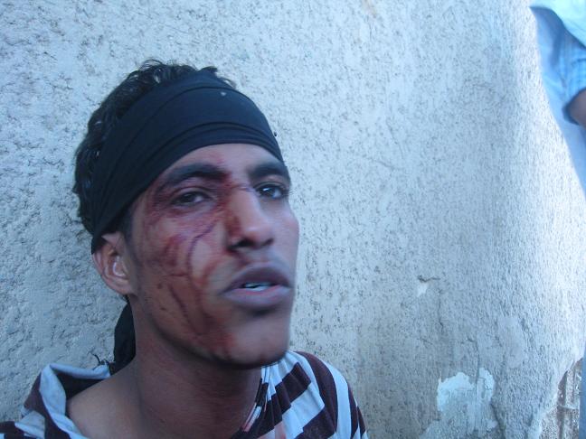أحد المتظاهرين سقط جريحا في الشارع دون وجود سيارة إسعاف(تصوير الأخبار)