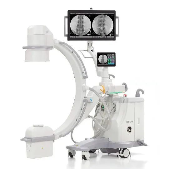 تعطّل جهاز الأشعة يربك عمليات مركز الكسور بالمستشفى الوطني