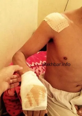 الأخبار تنشر صورا لبعض جرحى السجناء