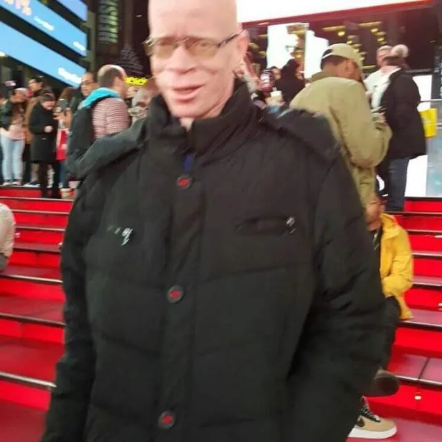 النجيب الداه اعليوه ـ رئيس لجنة المناصرة للمشاركة السياسية للأشخاص ?