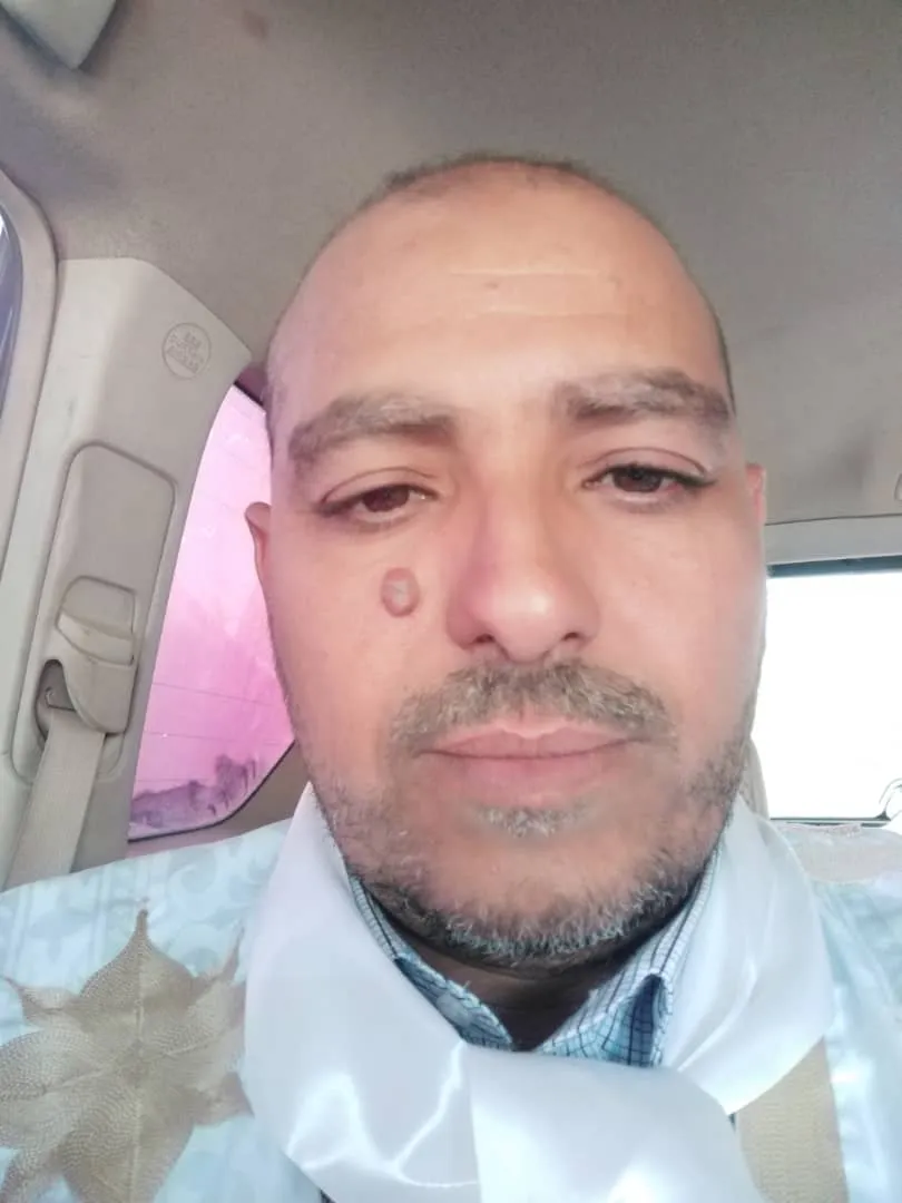 الأمين العام للنقابة الوطنية للموظفين ذوي الإعاقة جمال ولد عبد الجل?